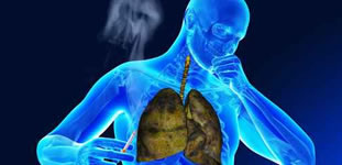 Enfisema pulmonar